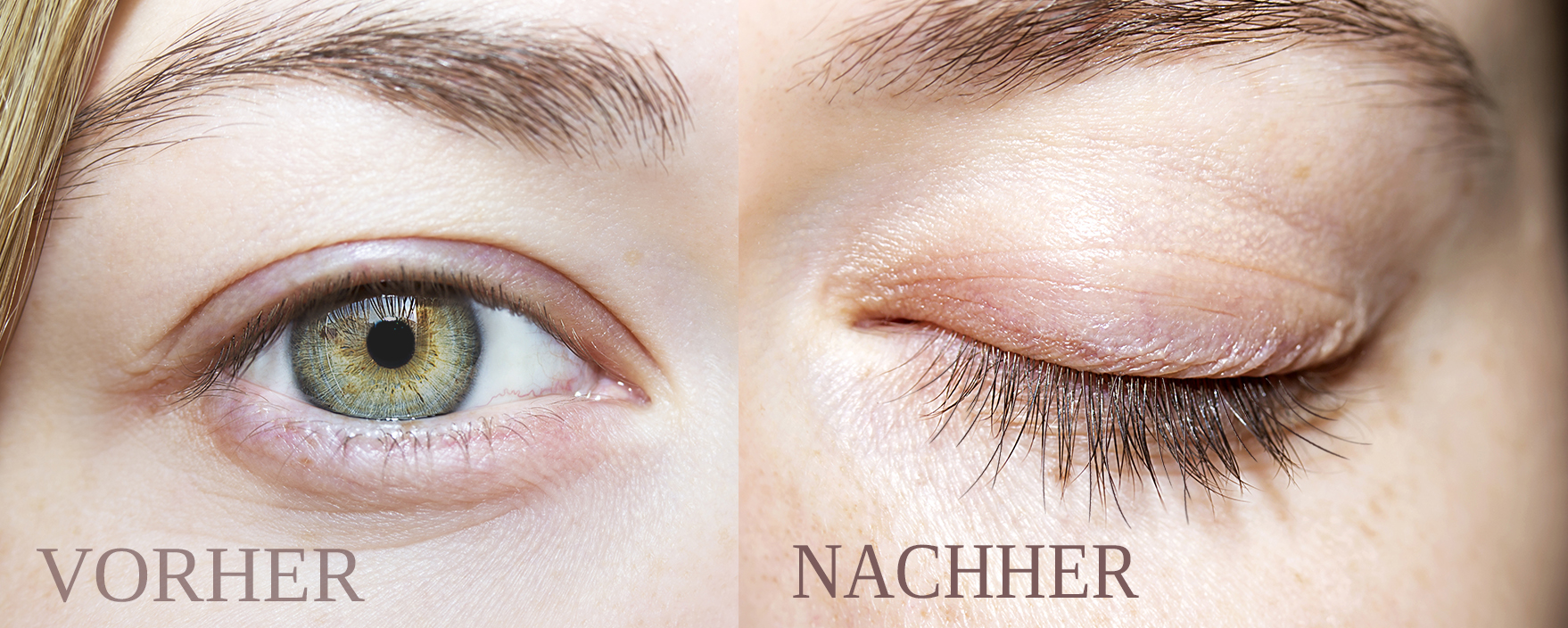 Wimpernserum Nanolash – Wimpern vor und nach der Behandlung
